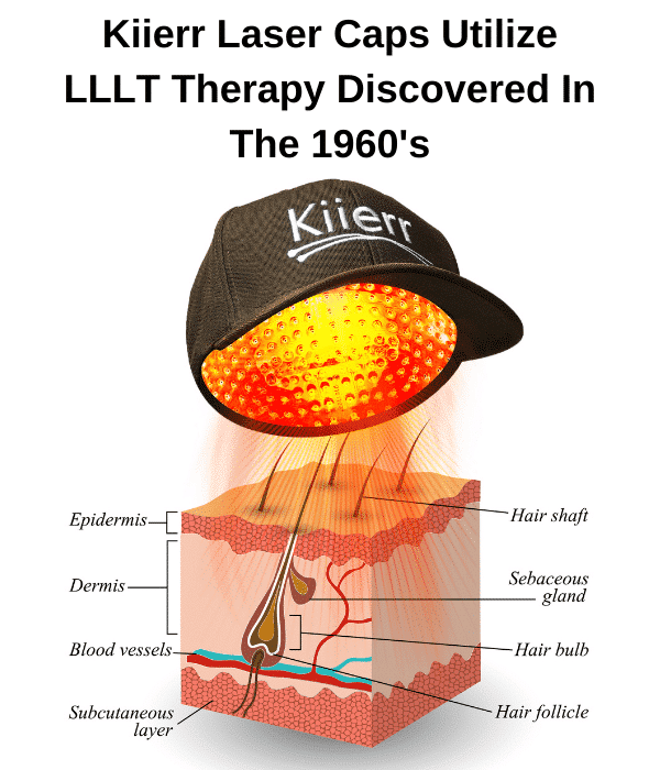 kiier laser cup technology