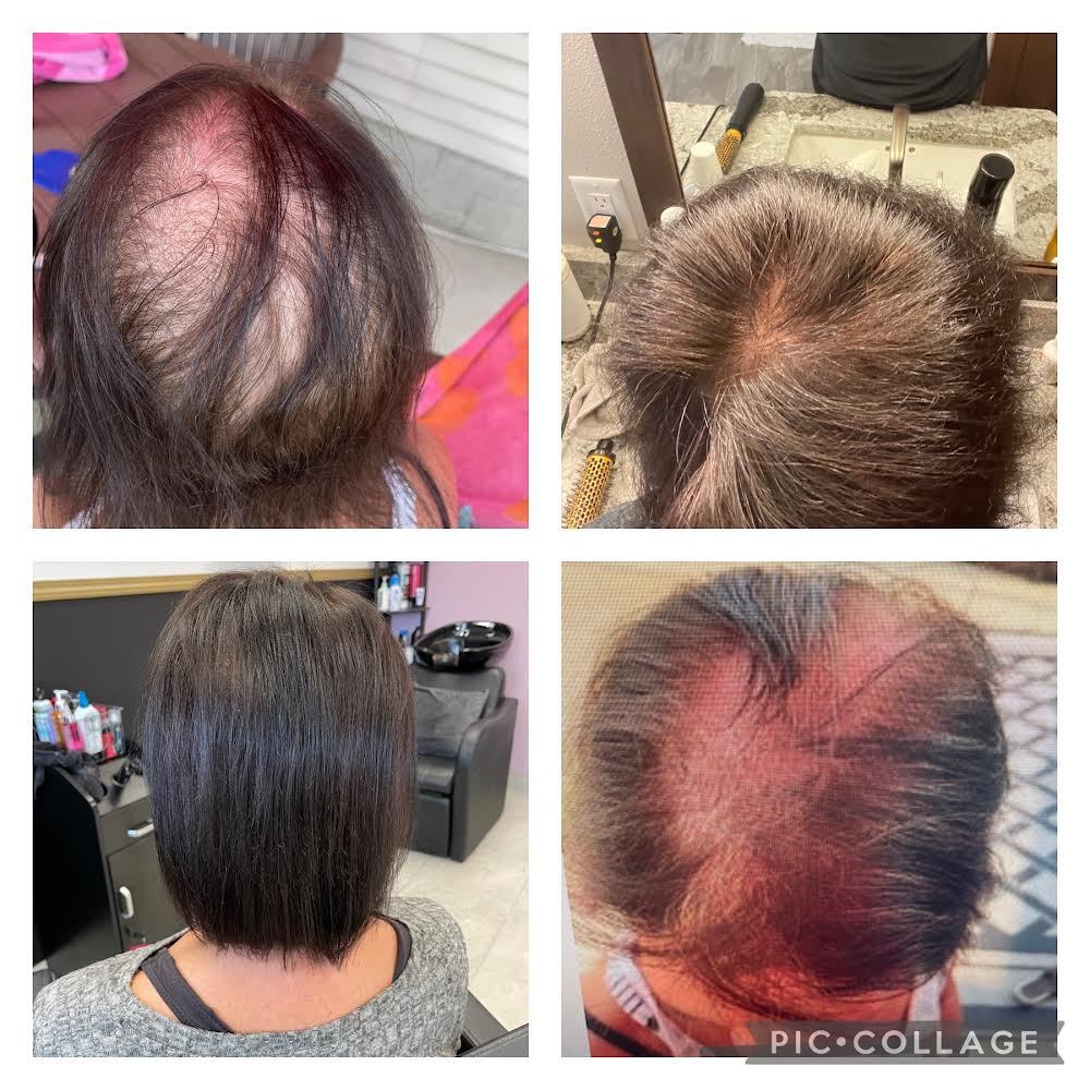 before after hair growth 6